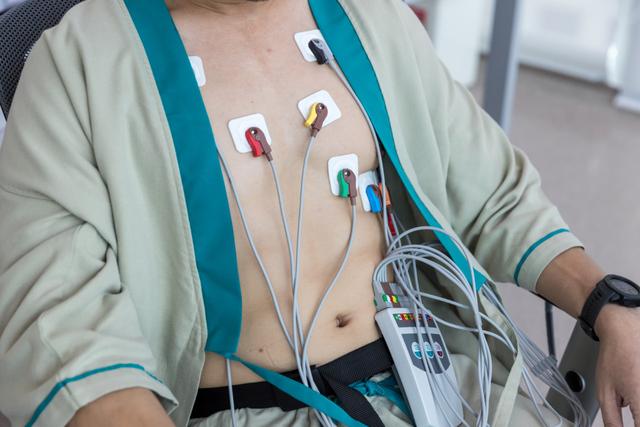 Electrocardiogram