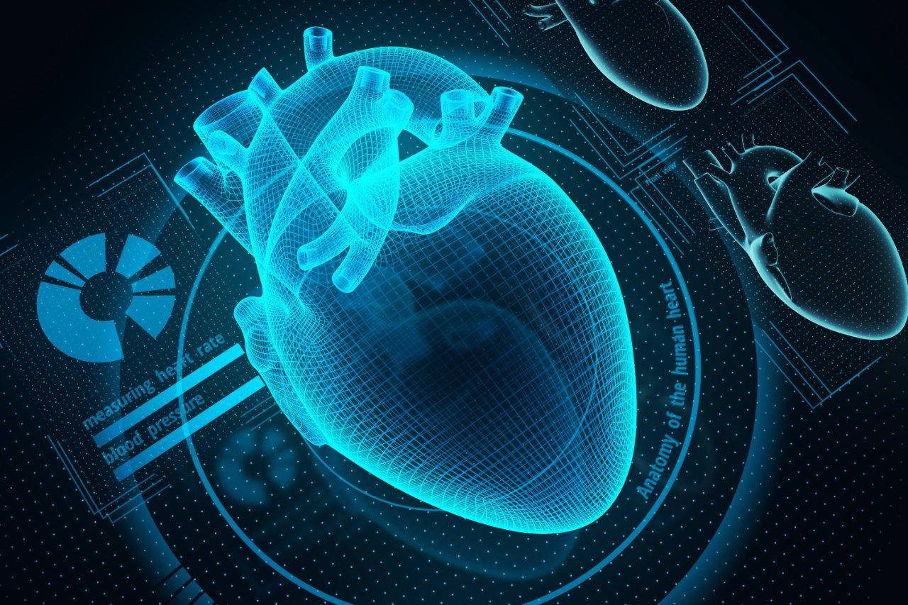 Cardiac Monitoring