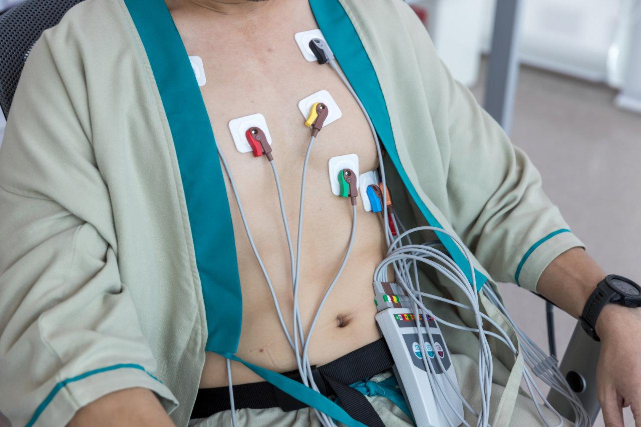 Electrocardiogram